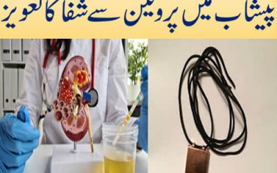 پیشاب میں پروٹین سے شفا کا تعویز