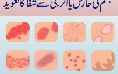 Jism Ki Kharish Aur Allergy Se Shifa Ka Taweez | Surah For Skin Allergy