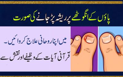 Paon Ka Angutha Main Resha Ka Ilaj | Angutha Main Dard | Nail Infection Treatment