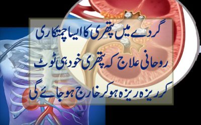 Gurdy Main Pathri Ka Rohani Ilaj | Gurday Ki Pathri Se Nijat Ka Taweez | Taweez For Kidney Pain