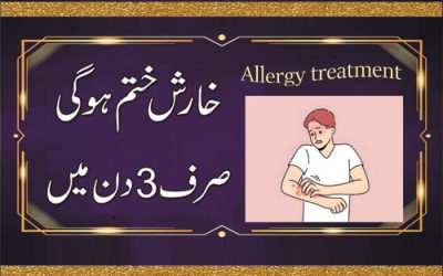 Kharish Khatam Karne Ka Wazifa | Kharish Ka Rohani Ilaj | Allergy Treatment