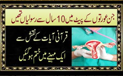 Pait Mein Rasoli Se Nijat Ka Naqsh | Har Qisam Ki Rasoli Ka Ilaj | Abdominal Tumor Treatment