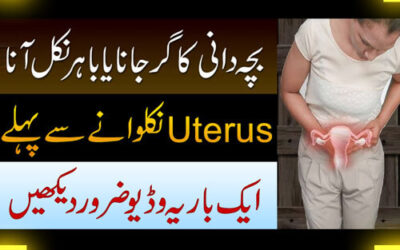 Uterus/Reham Ke Girne Ka Ilaj | Bacha Dani Ka Bahar Ana | Uterovaginal Prolapse Causes/Treatment