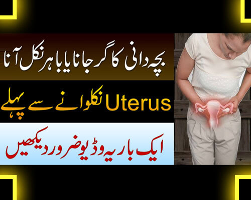 Uterus/Reham Ke Girne Ka Ilaj | Bacha Dani Ka Bahar Ana | Uterovaginal Prolapse Causes/Treatment